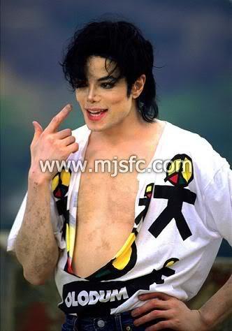 michael_vitiligo_11.jpg